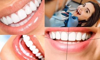 Diş Tasarımı - تصميم الاسنان Nasıl Olmalıdır?
